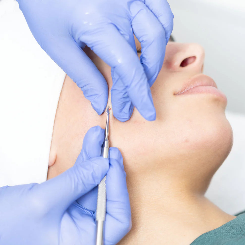 Person receiving a facial treatment with gloved hands holding a Preston Rxtractor tool