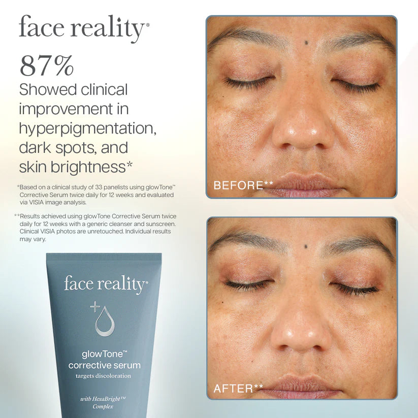 Advertisement for face reality serum showing before and after effects on skin.